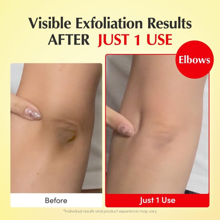 617C0cpMCEL._AC_SL1500_ 617C0cpMCEL._AC_SL1500_