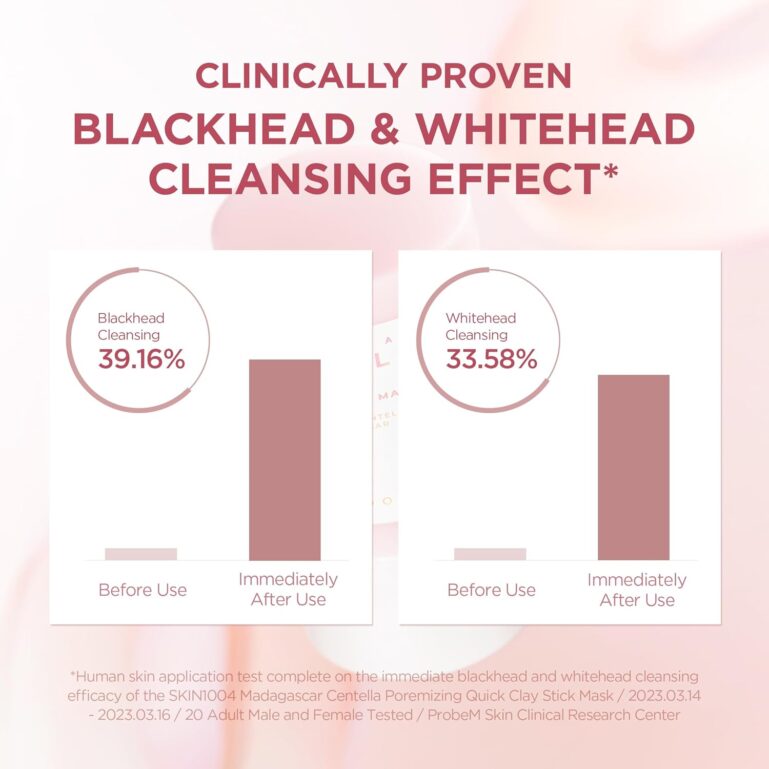 71-EKwRmIGL._SL1500_