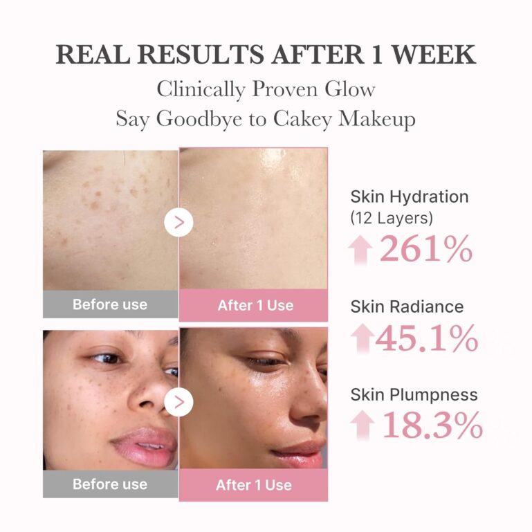 7119uKmxKuL._SL1500_