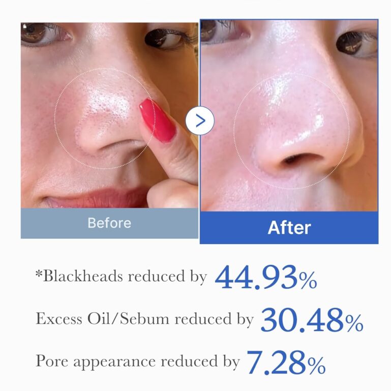 717cIqziH6L._AC_SL1500_