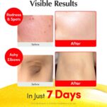 71BmMnxG3wL._AC_SL1500_