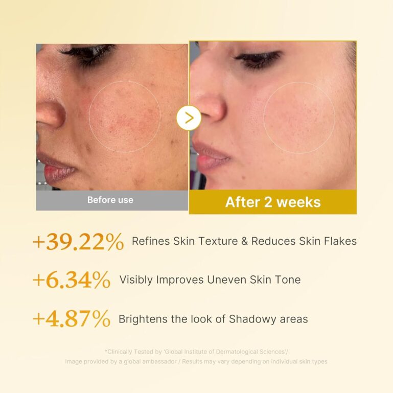 71Mi7n2IgaL._AC_SL1500_ 71Mi7n2IgaL._AC_SL1500_