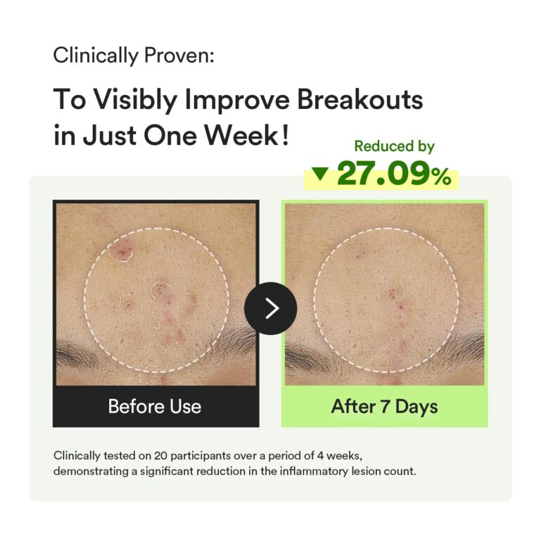 71+Mp08fkPL._SL1500_ 71+Mp08fkPL._SL1500_