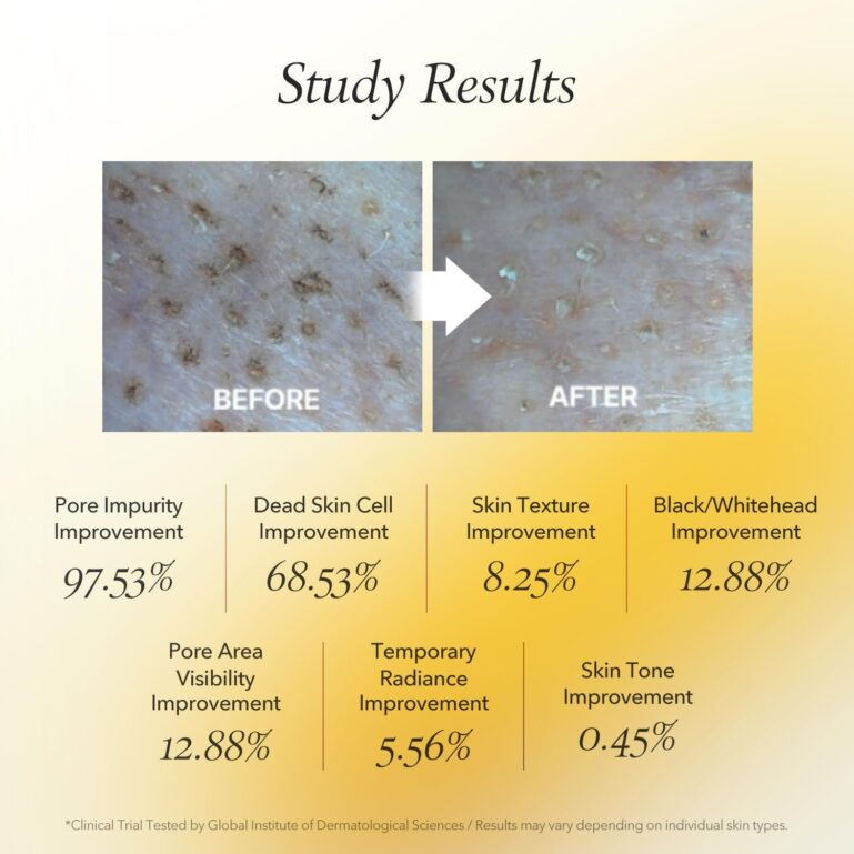 71Q3tqwpGgL._AC_SL1500_ 71Q3tqwpGgL._AC_SL1500_