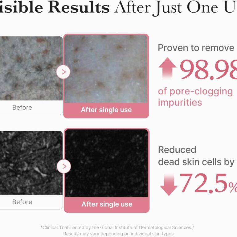 71Us01MSW7L._AC_SL1500_ 71Us01MSW7L._AC_SL1500_