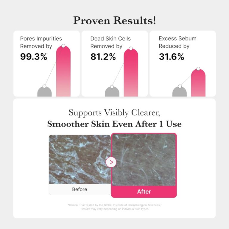 71gnDfQ1VoL._AC_SL1500_ 71gnDfQ1VoL._AC_SL1500_