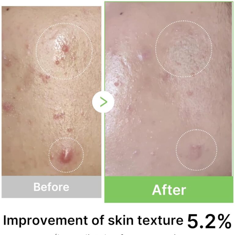 71jSYLVEI-L._AC_SL1500_