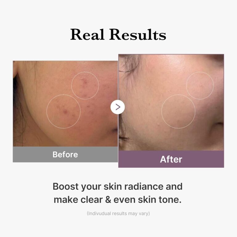 71lbkdI5x6L._AC_SL1500_ 71lbkdI5x6L._AC_SL1500_