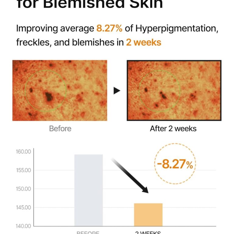 71ozbUcDttL._SL1500_