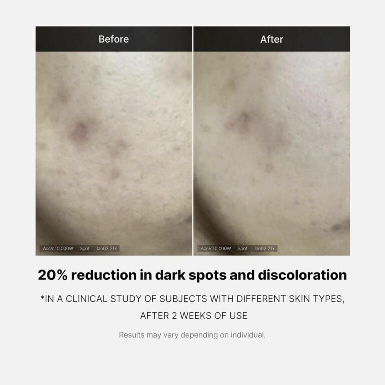 71zKOSNxc3L._AC_SL1500_