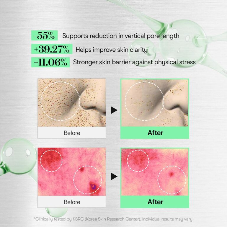 81cgKFDE6tL._SL1500_ 81cgKFDE6tL._SL1500_