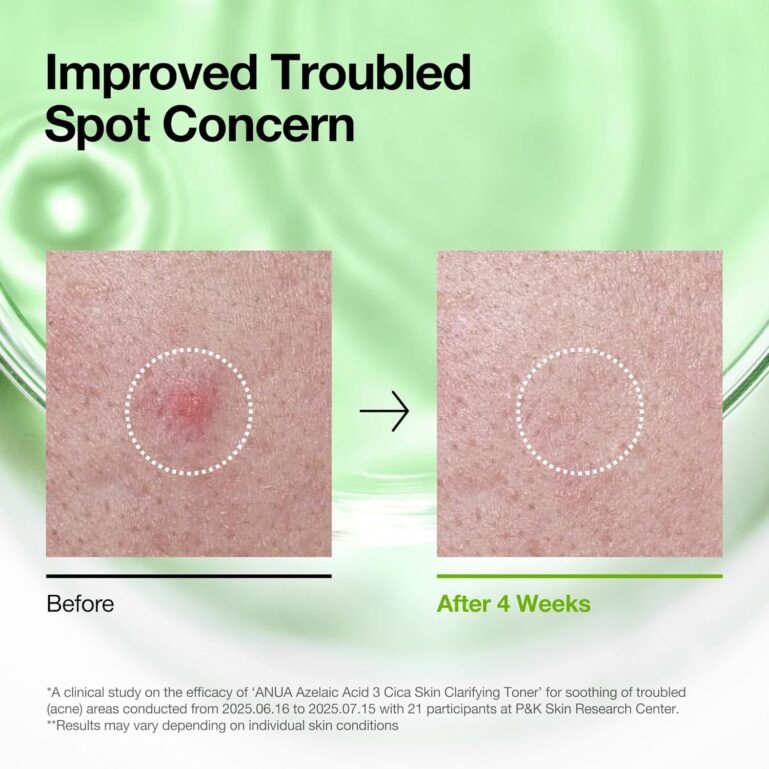 81jskIaI+AL._AC_SL1500_