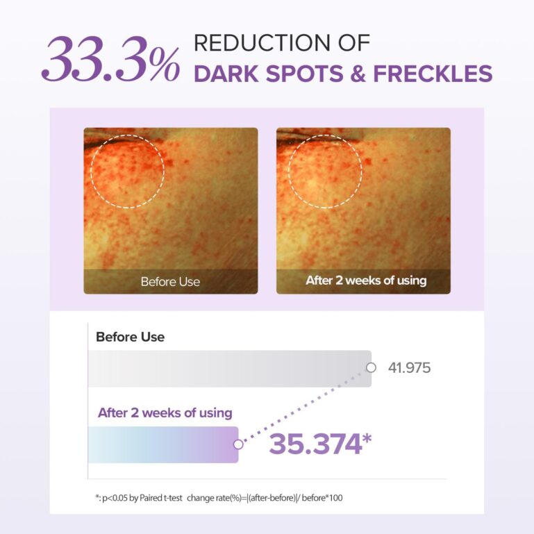 616WobfFVfL._AC_SL1500_ 616WobfFVfL._AC_SL1500_