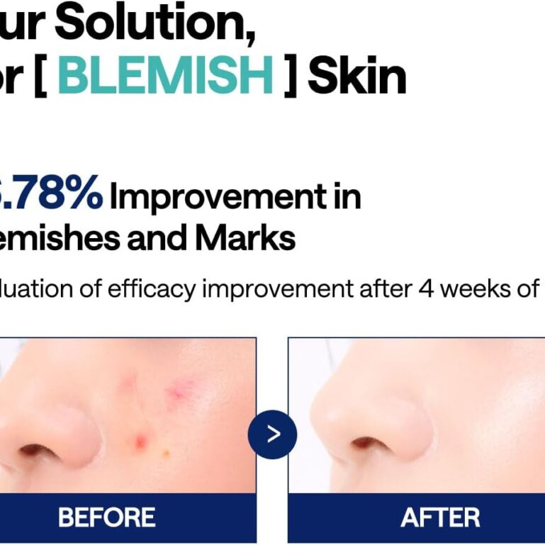 61JXaRCgSFL._AC_SL1200_ 61JXaRCgSFL._AC_SL1200_