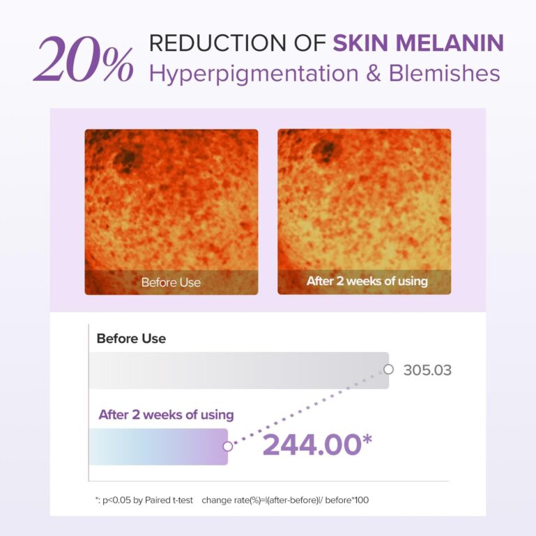 61YneG4zZ8L._AC_SL1500_ 61YneG4zZ8L._AC_SL1500_