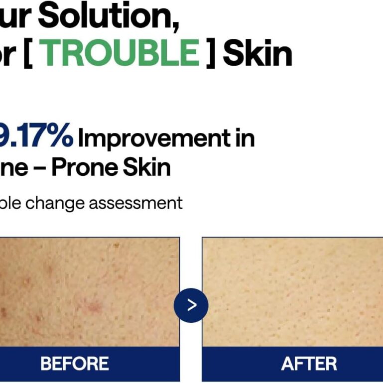 61xWaDSlbdL._AC_SL1200_