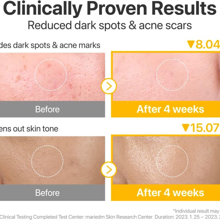 71TsSgLlRDL._AC_SL1500_