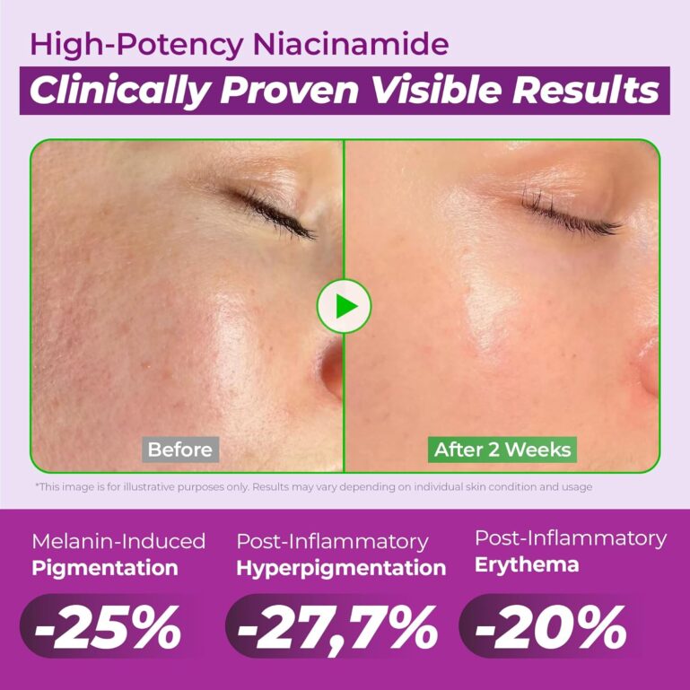 811QK9HadVL._AC_SL1500_