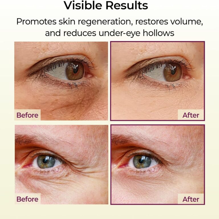 81rUZAy9yNL._AC_SL1500_ 81rUZAy9yNL._AC_SL1500_