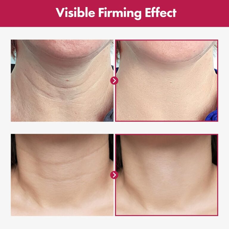 717Z0IHMyYL._AC_SL1500_