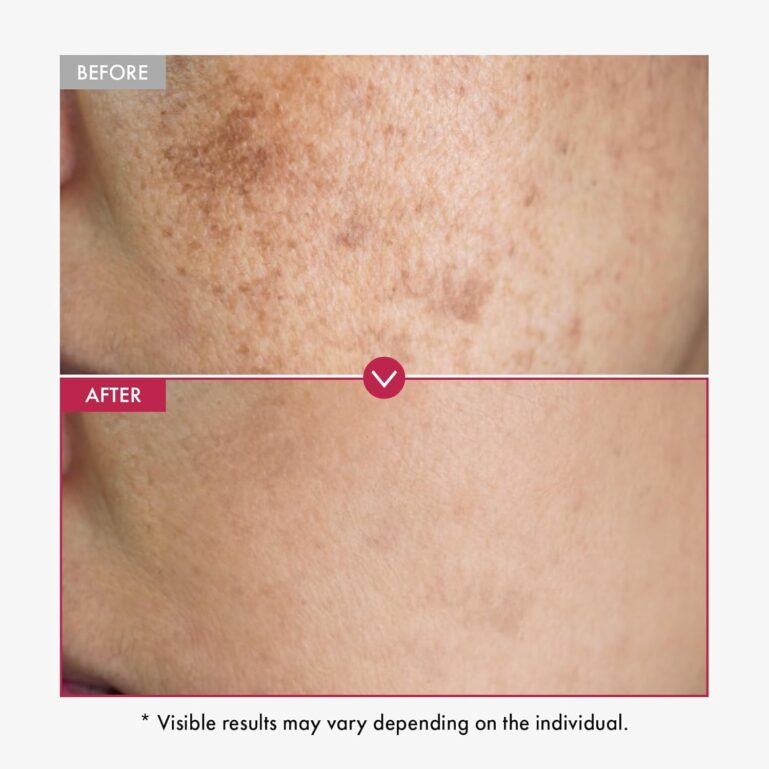 71M7TeN7sHL._AC_SL1500_ 71M7TeN7sHL._AC_SL1500_