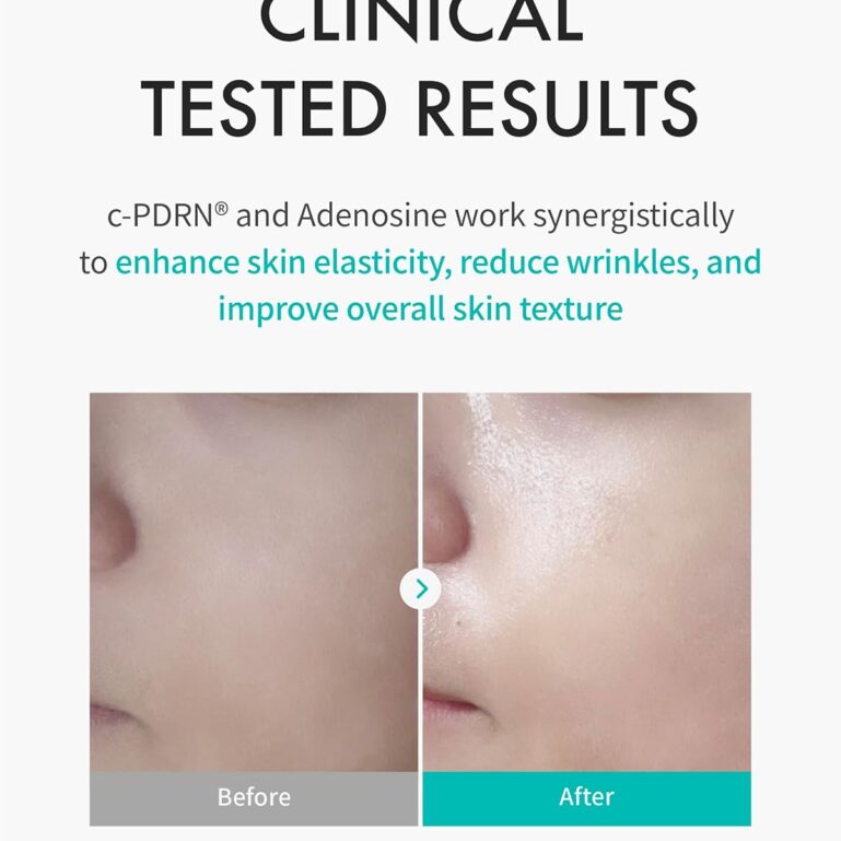 71+XmF8EgnL._SL1500_ 71+XmF8EgnL._SL1500_