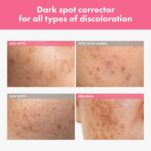 71fTkpw-v4L._AC_SL1500_ (1)