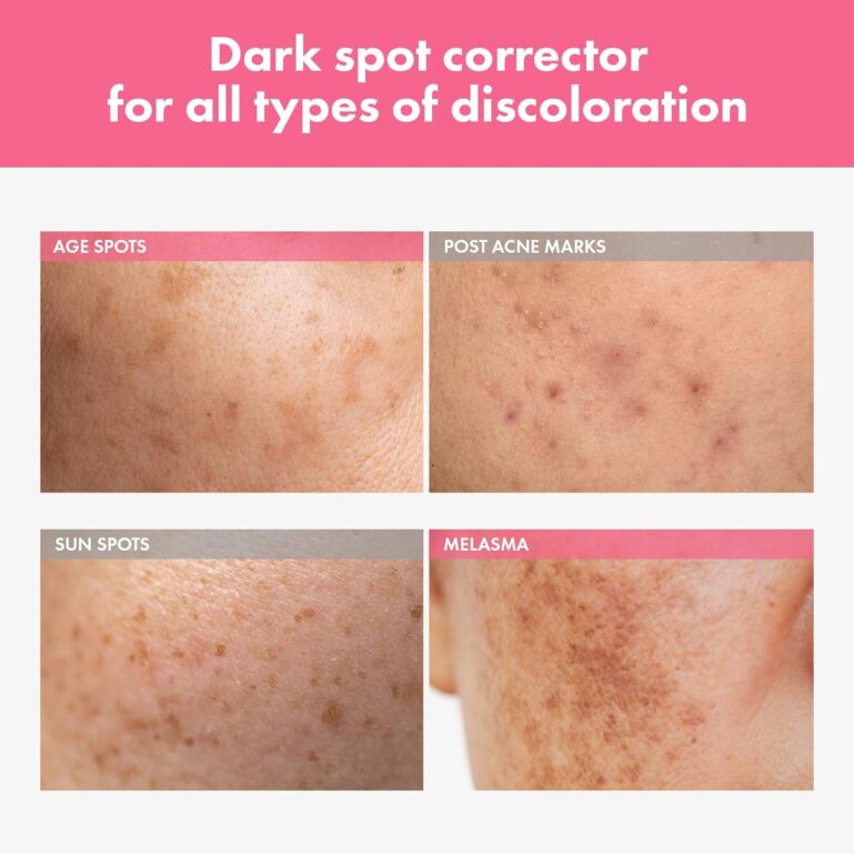 71fTkpw-v4L._AC_SL1500_ (1)