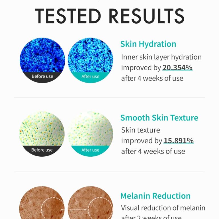 71rFeYXILKL._SL1500_ 71rFeYXILKL._SL1500_